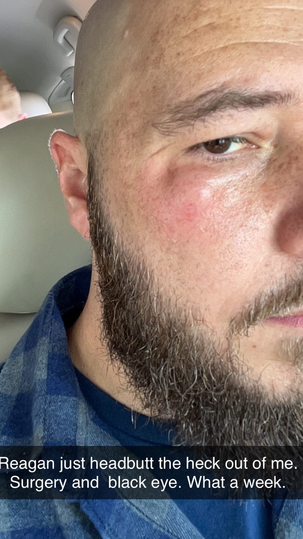 Parent recovering from surgery with playful toddler