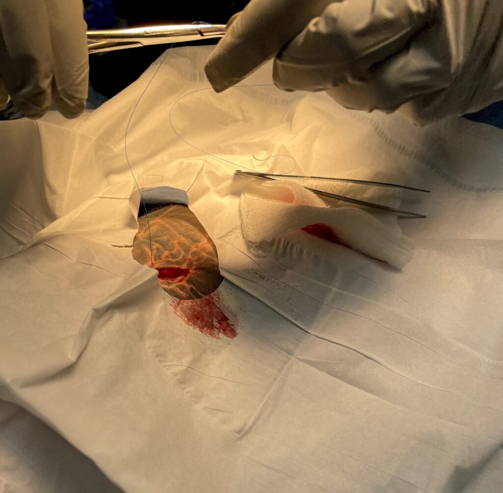 Hospital stay, Stiches, Surgery