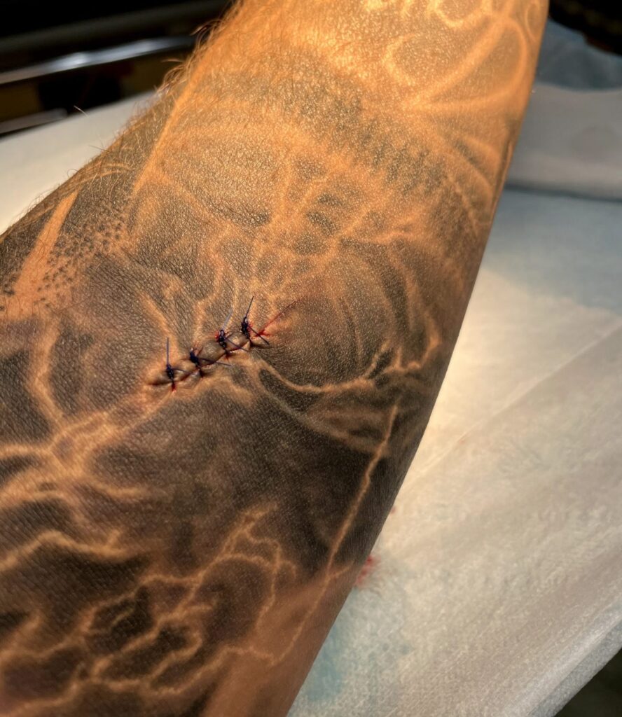 Tattoo, Stitches, Daily Reminder